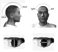 Cephalic index