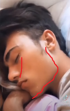 Perfect facial development