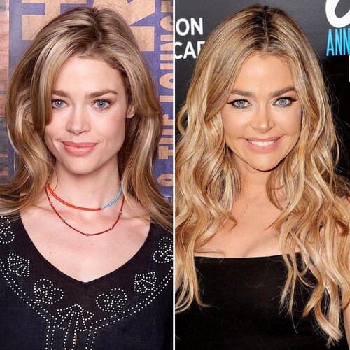 Denise-Richards-before-and-after-plastic-surgery.jpg