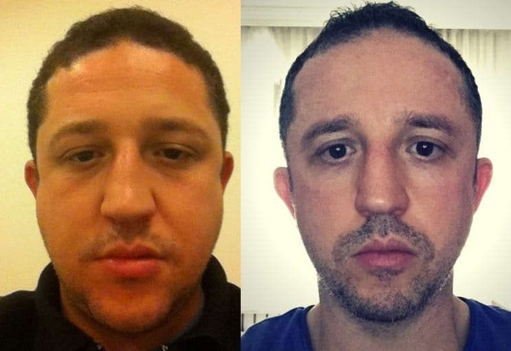 Fat face chiseled face before after