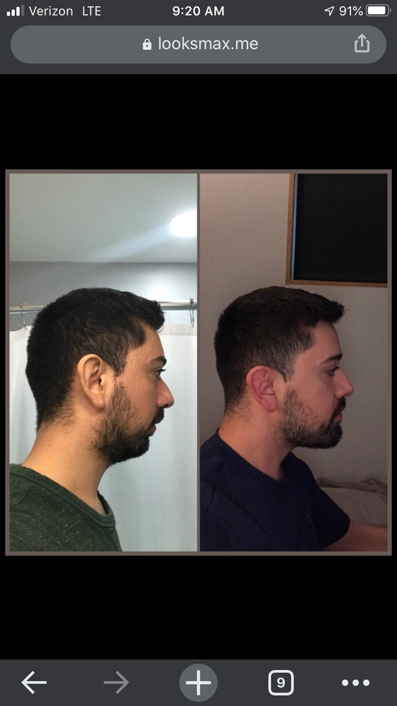 A4744FC7 78FB 45A2 8951 69EE45015FDE