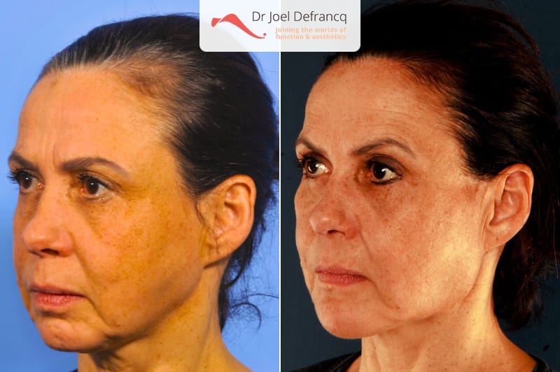 Dr Joel Defrancq 1534585520011893200 1842 1