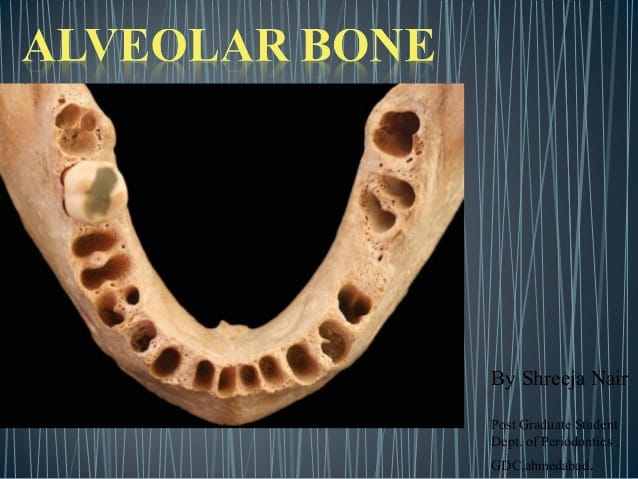 Alveolar bone in health seminar 1 638