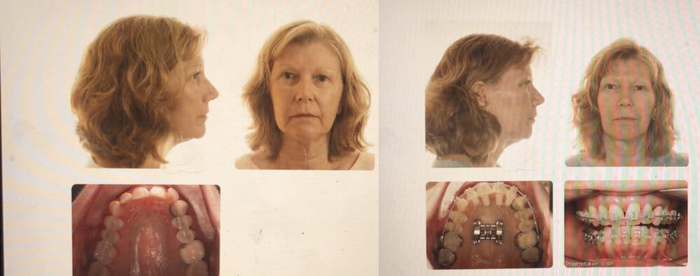 Imgonline com ua twotoone SpkfDEOYLqY