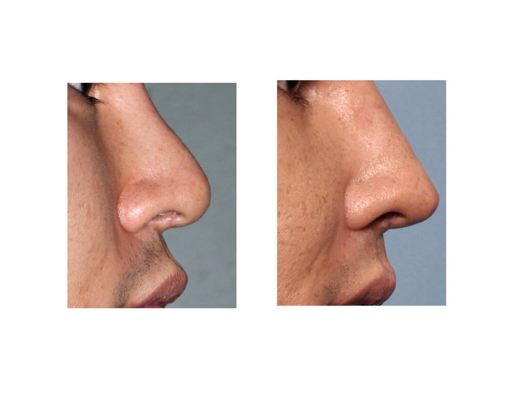 3485BF12 5B7B 4AF5 80F6 FB46605B4BD3