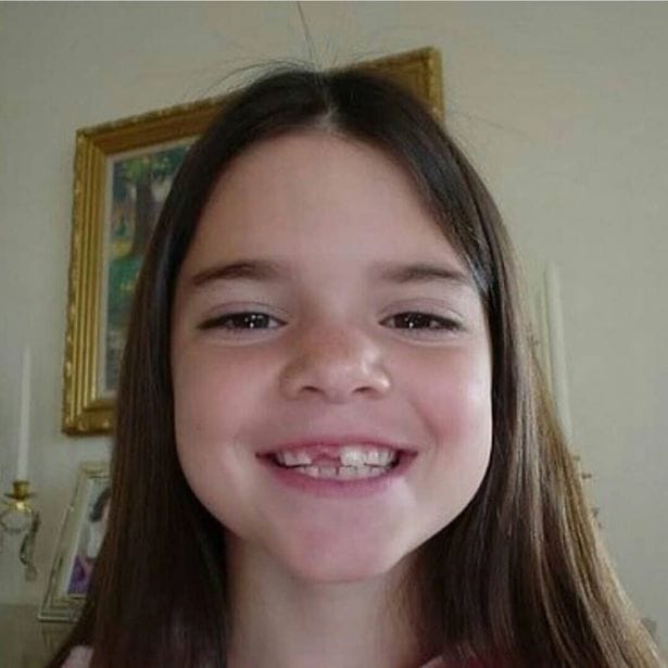 1 Kendall Jenners amazing transformation from cute toothless smile to catwalk queen