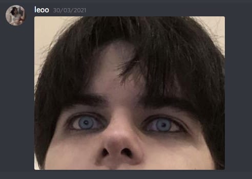 X 1
