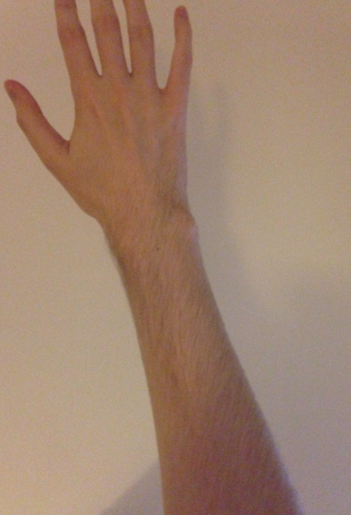 FRzKNIG