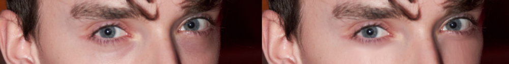 Zdjcia 2 before after