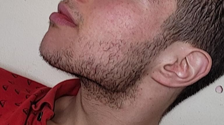 Baardfillin