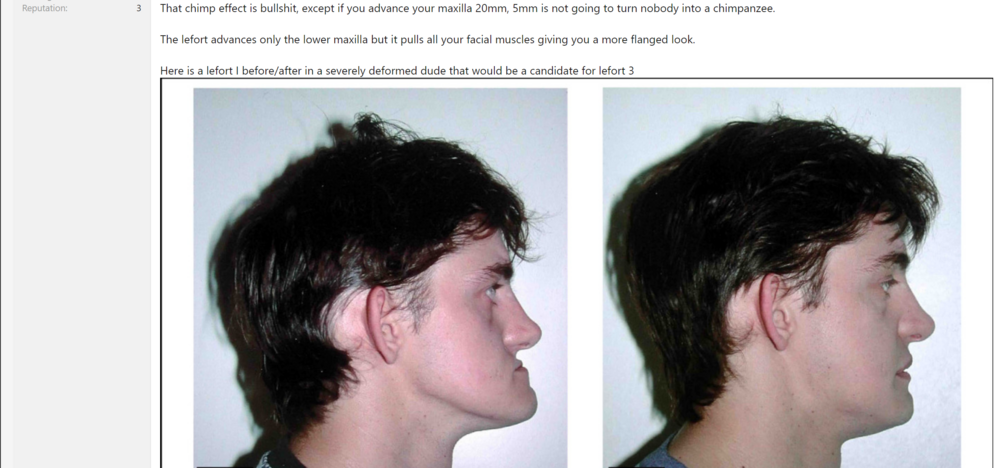 Chimp lip 1PNG 3