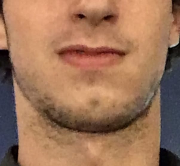 Lord madness bimax result abefore