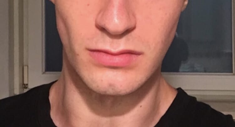 Lord madness bimax result after 2