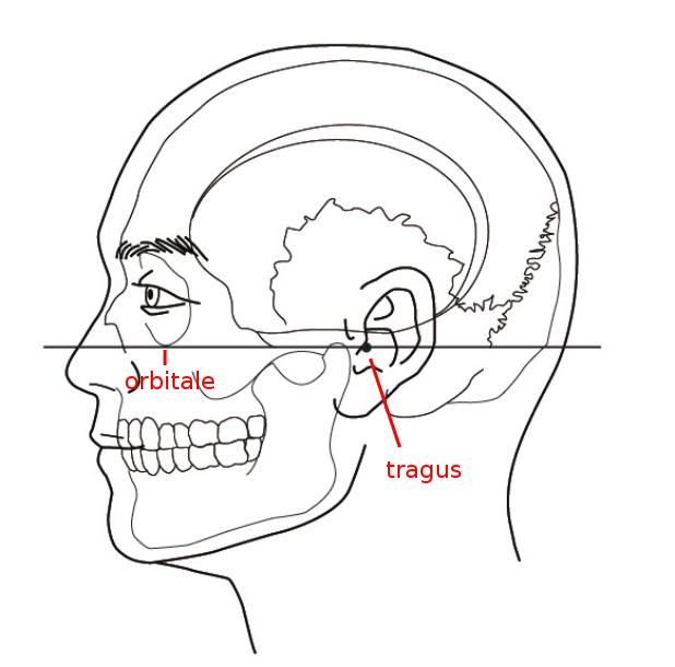 Head alignment according to the Frankfurt plane
