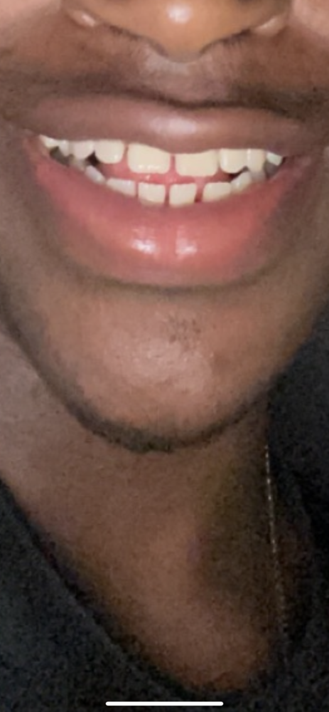 BF3DEADA A8AA 440D AD10 E547D04E978A