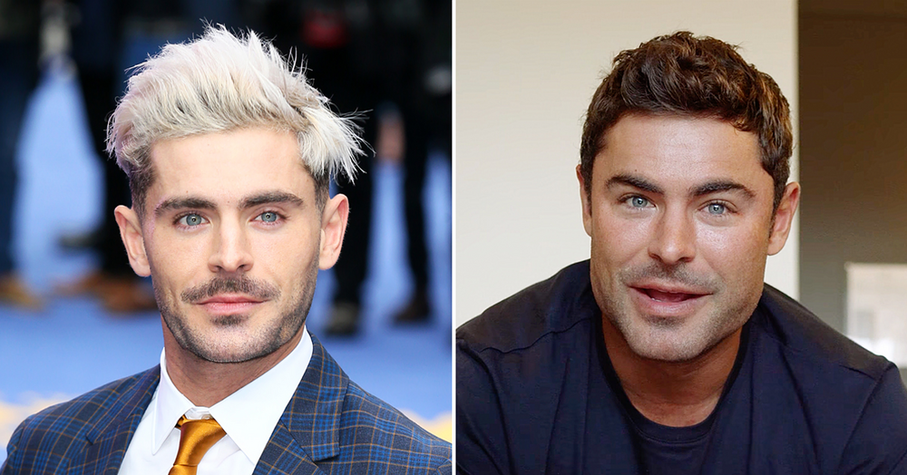 Zac efron plastic surgery jawline filler 1619211036814 1