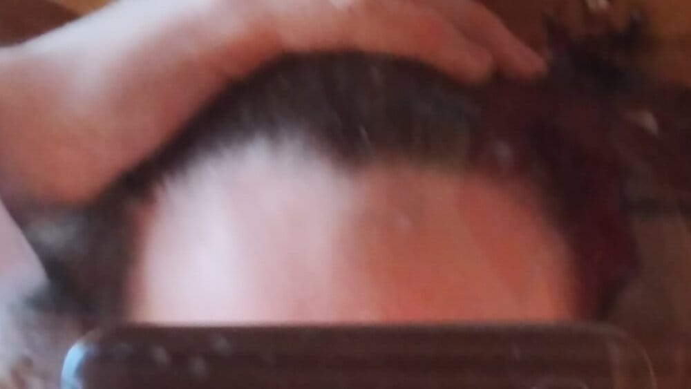 Bald