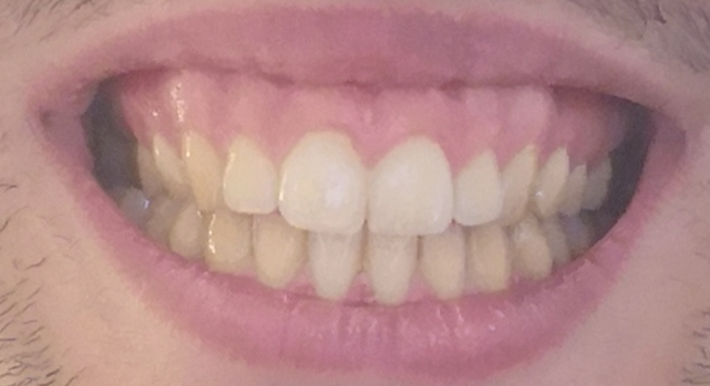 Big smile
