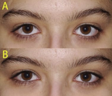 1 s20 S1010518218304049 gr2