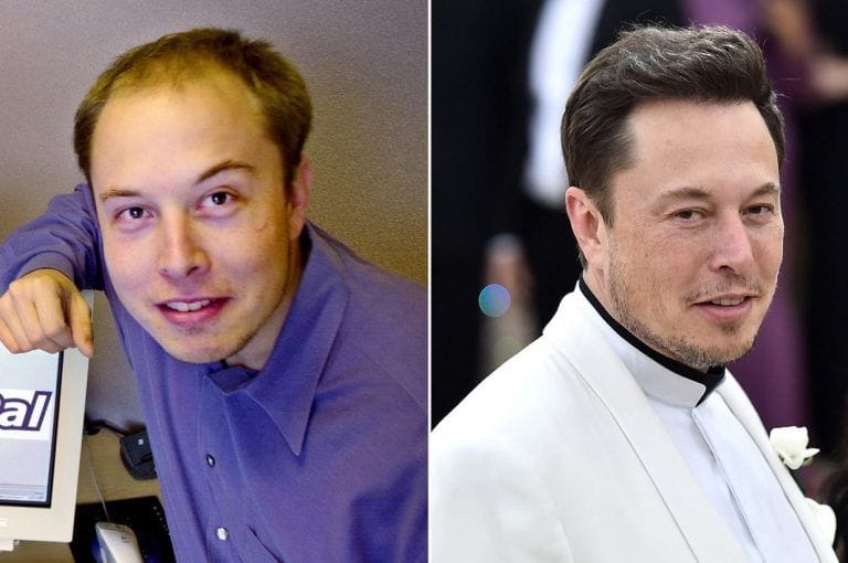 Elon musk celebrities with hair transplants 768x510