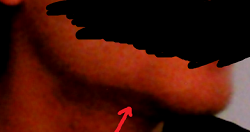 Notch