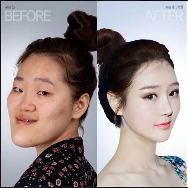 Kor1