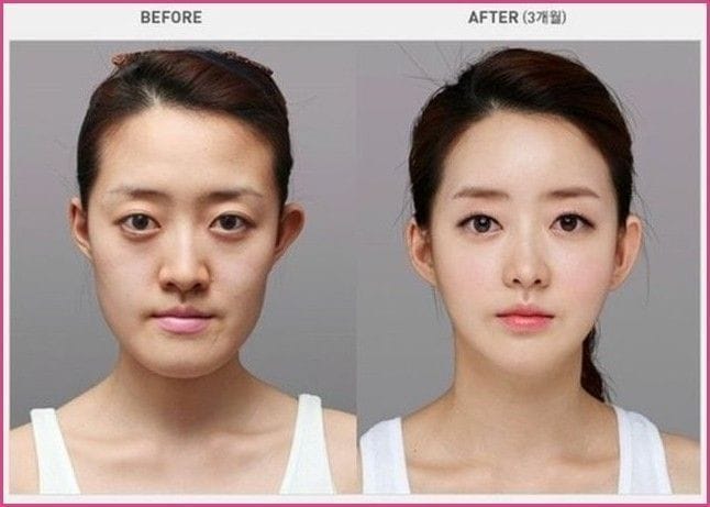 Kor4