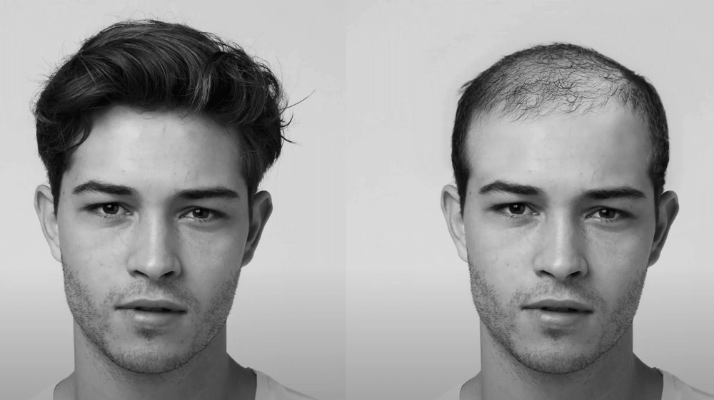 Hair is not cope retard