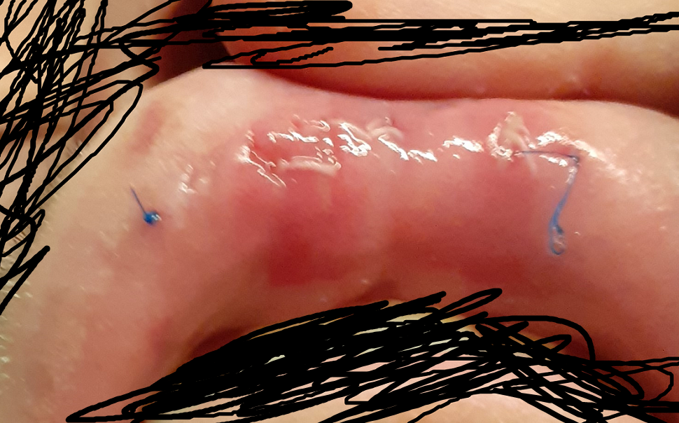 Fffstitch