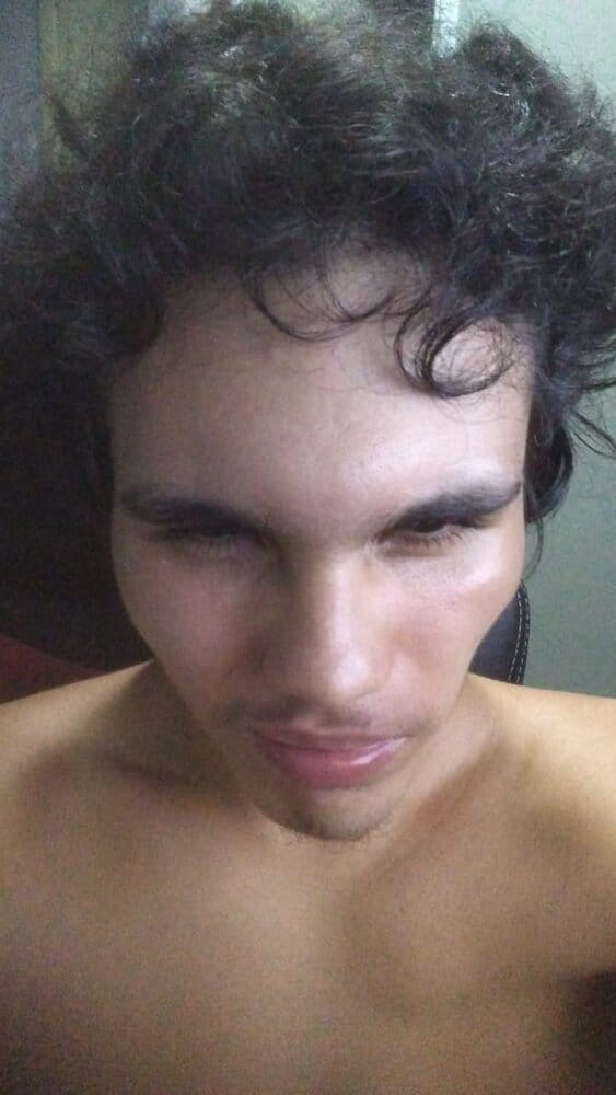 Autism 1