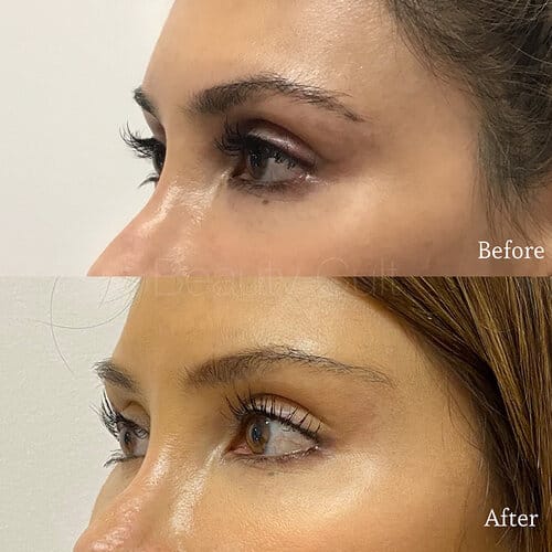 Beforeandafter