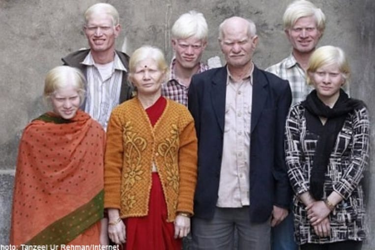 Albino mainpic 1