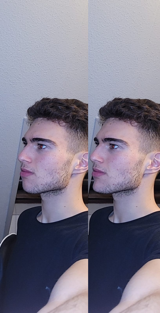 Kinbeforeafter