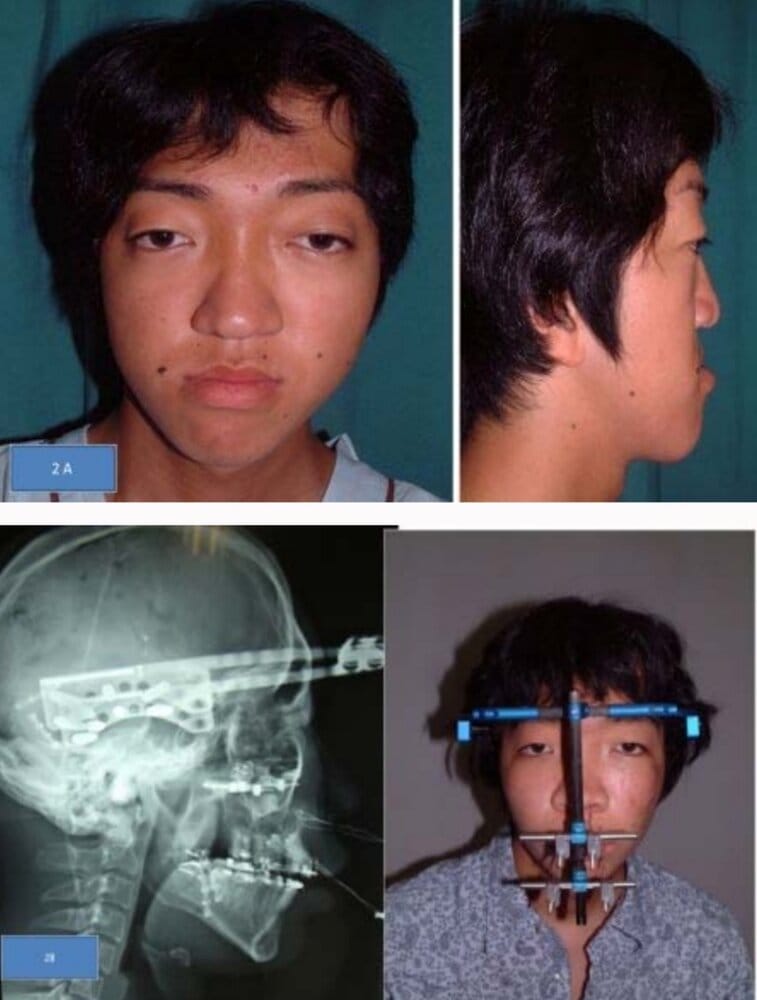 Screenshot 20201112 221258 Drive 01