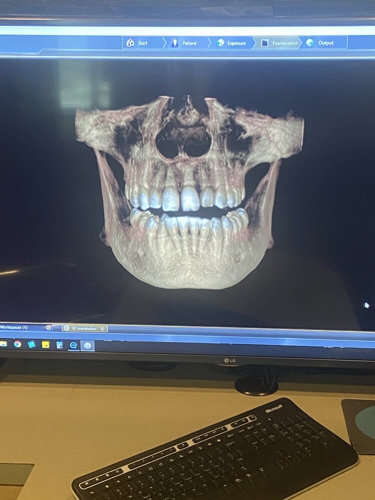 FCE8117B 77CF 48D7 9005 57D6860B4197