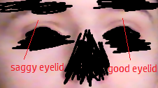 Eyes