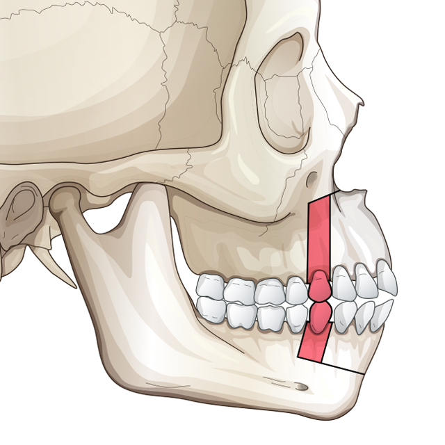 Img twojaw threejaw 2 1