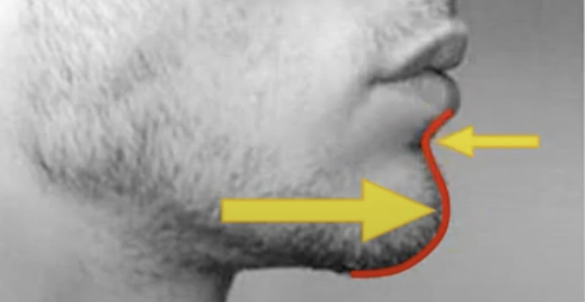 Good chin