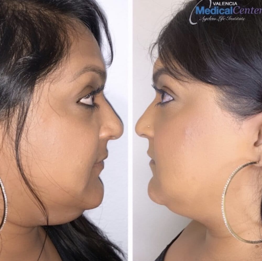 0122F18B 8BF8 4779 B68F 677678342957