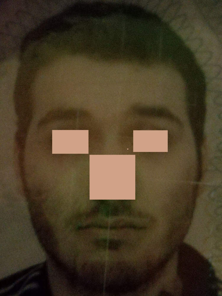 Zygo