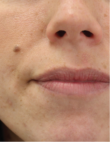 Mole removal leeds bradford banner right 2