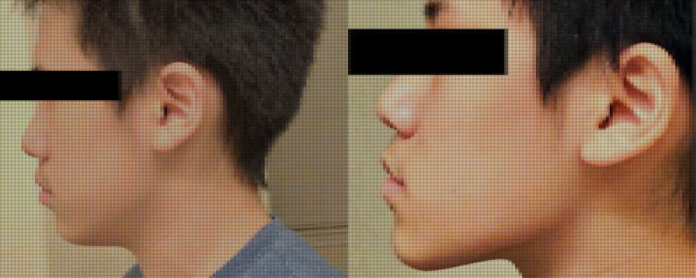 Hard Coping Spot Cleaned Info Hidden Ultra