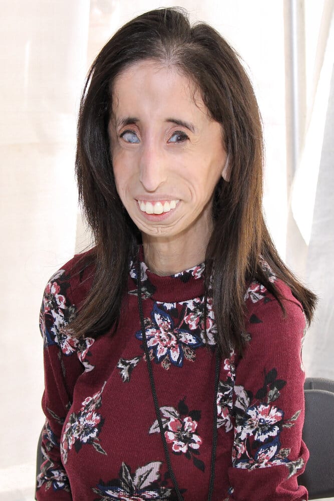 Lizzie Velasquez 2017