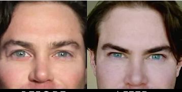 Brows