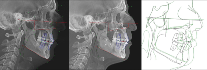 11325 2020 2279 Fig1 HTML