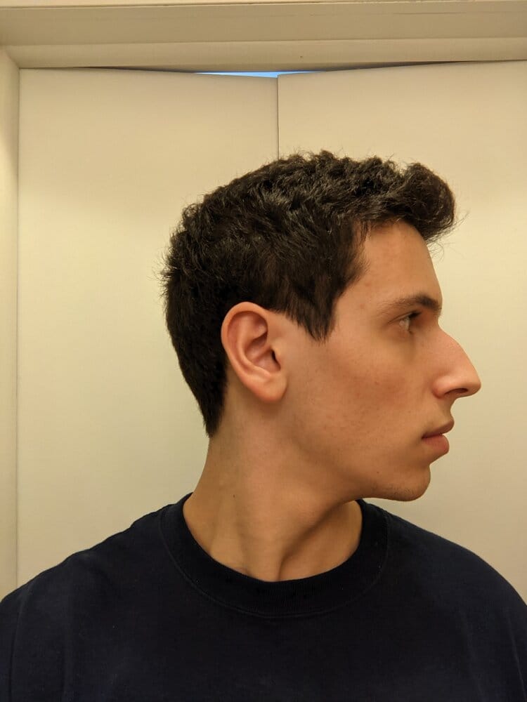 Side Side