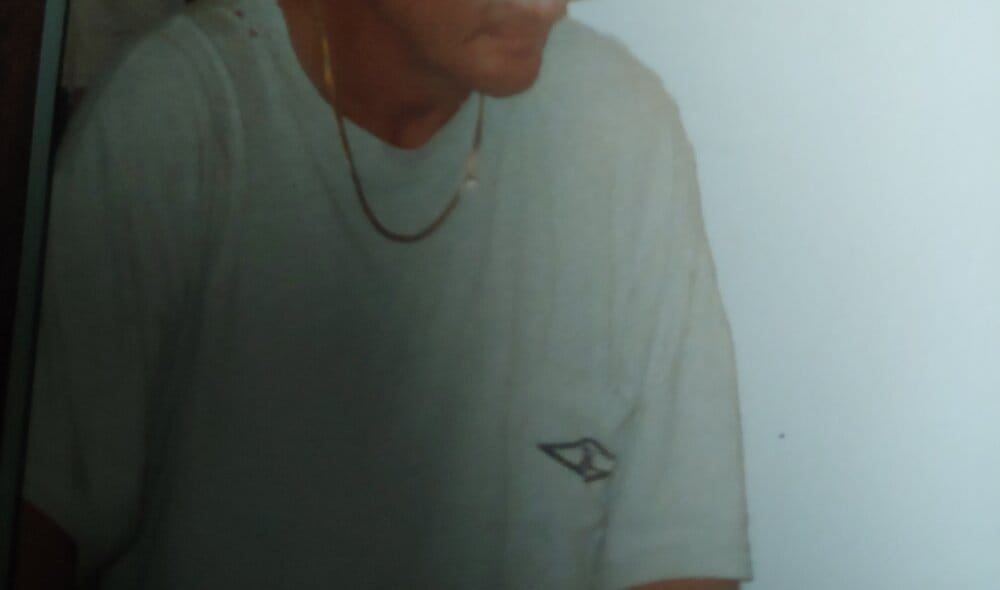 Huge chin2