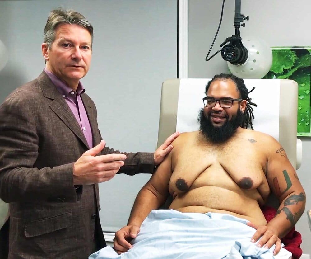 Loose skin after gynecomastia surgery