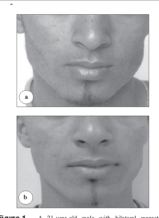 2 Figure1 1