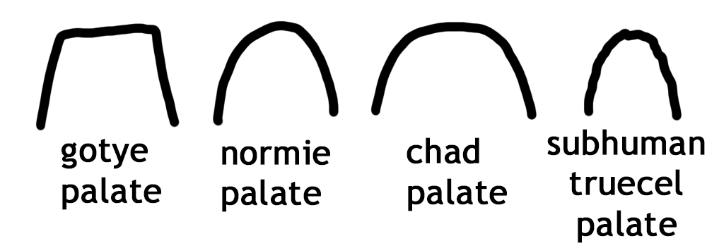 Palate